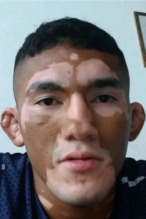 Albert Duraev ha trabajado con Melquizael Costa en 1 ocasiones