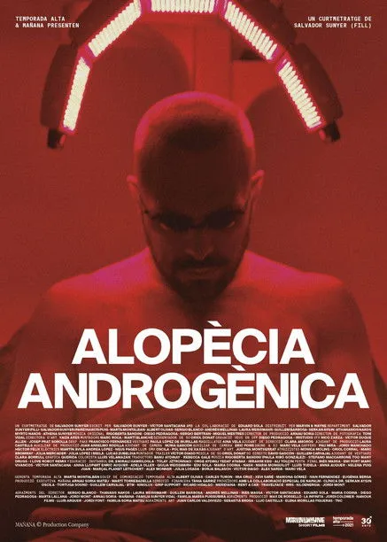 Guillem Barbosa interpreta a Self en Alopècia androgènica