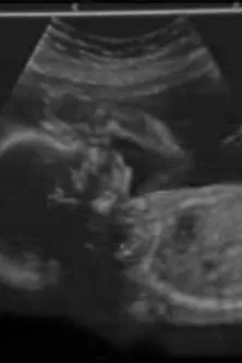 Jose Maria Bigas Canals interpreta a Himself en Con el corazón