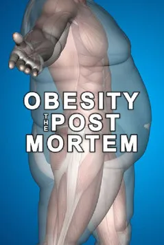 Vinette Robinson interpreta a Narrator en Obesity: The Post Mortem