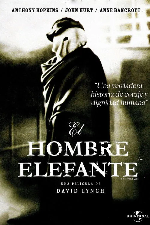 Richard Hunter interpreta a Hodges en El hombre elefante