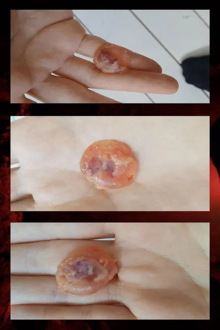 Eija Vilpas interpreta a Toxoplasma Gondii en Sydämestä