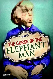 Peter Hayden interpreta a Dr. Frederick Treves en The Curse of the Elephant Man